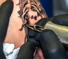 La forma más rápida de eliminar un tatuaje